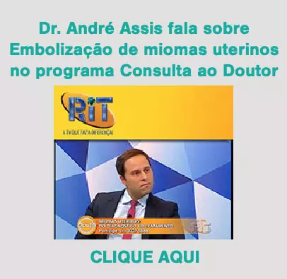 embolização de miomas