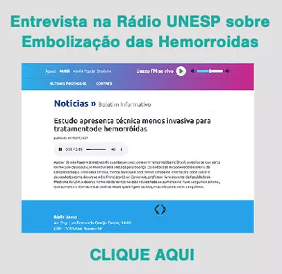 embolização de hemorroidas