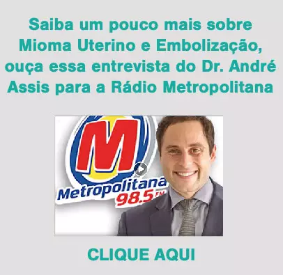 embolização de mioma uterino