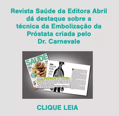 hiperplasia benigna da próstata