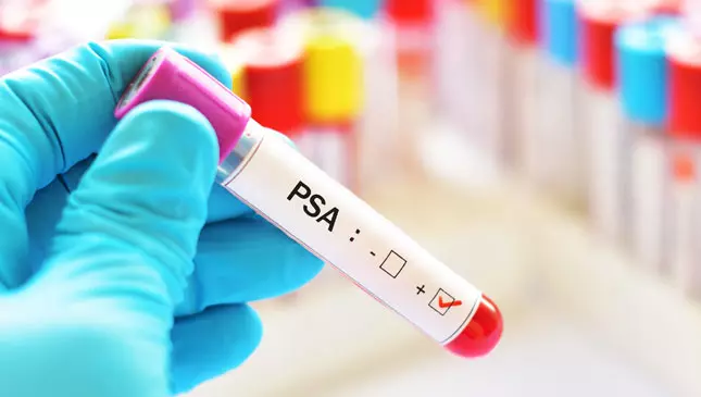 exame de psa